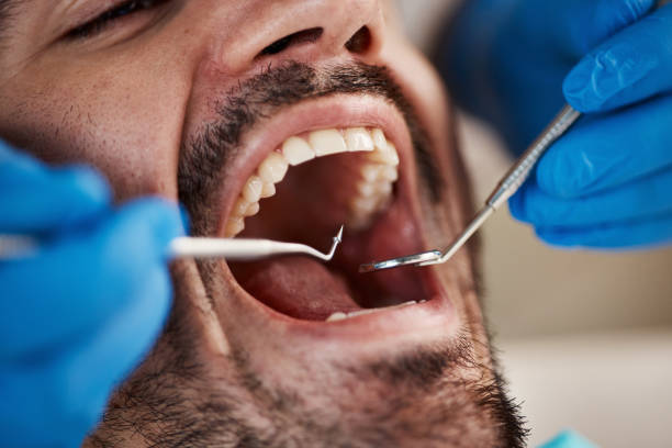 Best Chipped Tooth Repair Near Me  in Bryn Mawr, PA